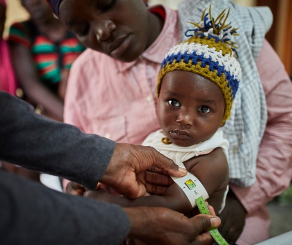 Measuring a child’s mid-upper arm circumference with a color-coded, graduated band is a cheap and simple way to detect undernutrition.