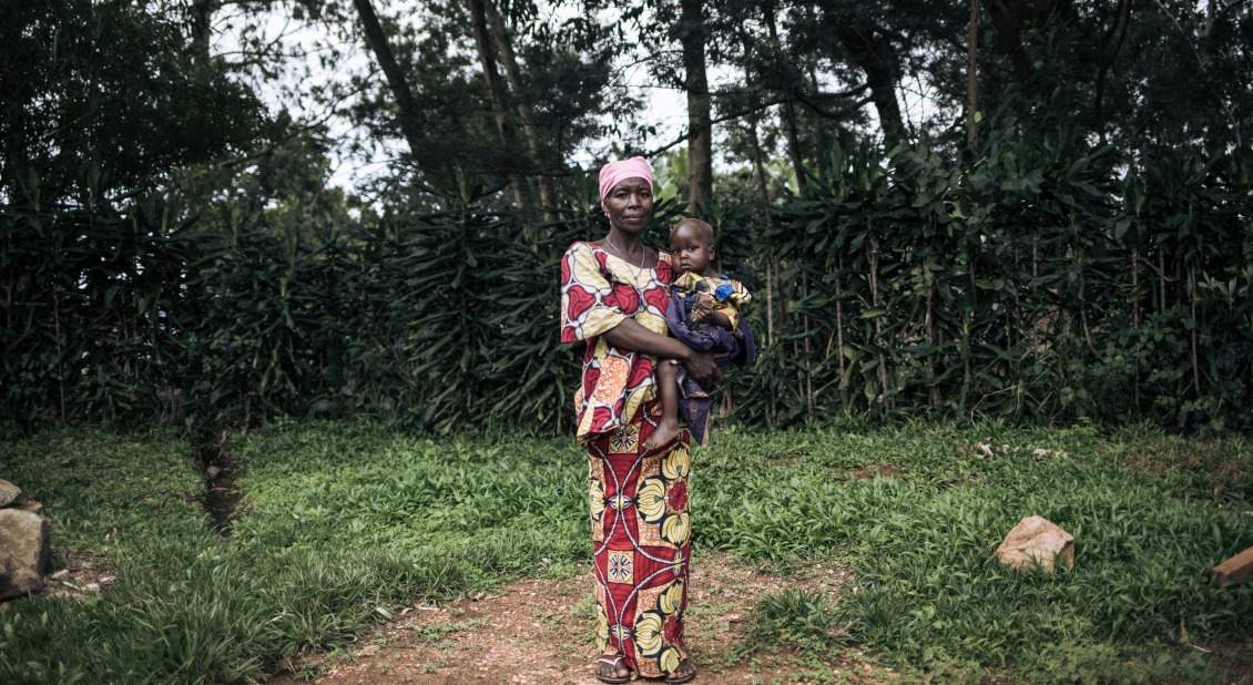 Georgine Dz'dha Nzale holds her 27-month-old son, David Wauba, who suffers from severe acute malnutrition, near the Drodro Health Center in Ituri, northeastern Democratic Republic of Congo.