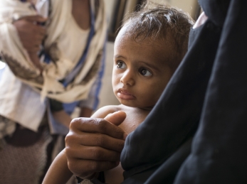 A child is treated at one of Action Against Hunger's health clinics in Yemen.