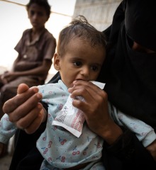 A child receives treatment for malnutrition from his mother