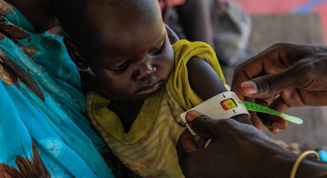 Atong's upper arm is measured, and she is diagnosed with severe acute malnutrition. Her case is a complicated one - she also has pneumonia.